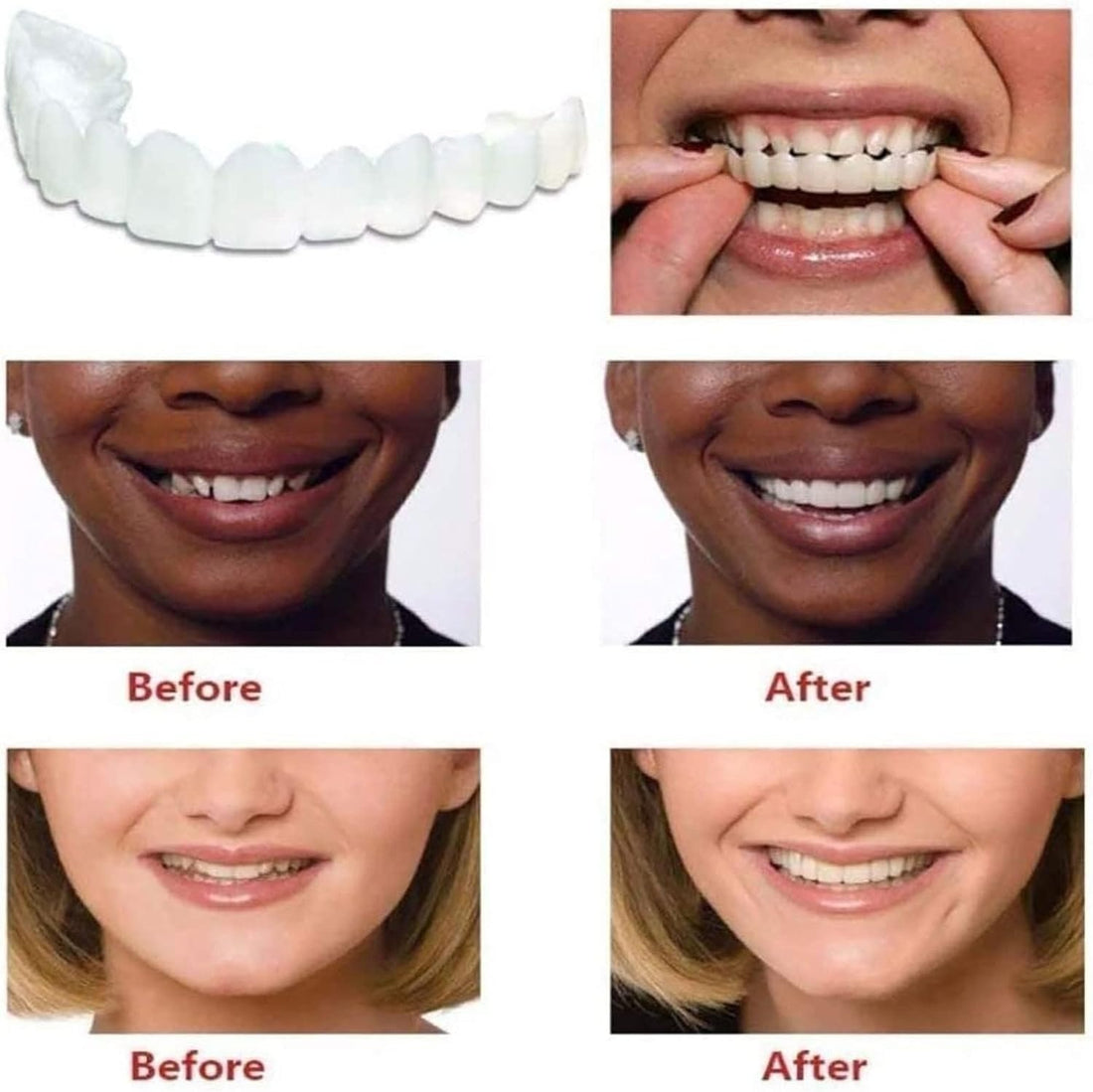Snap in Teeth for Men and Women