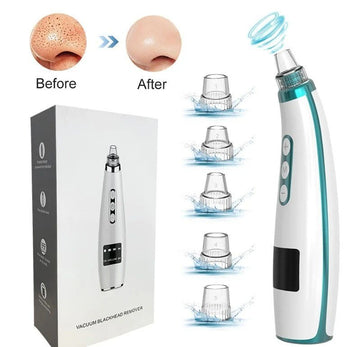 Blackhead Remover Pore Vacuum